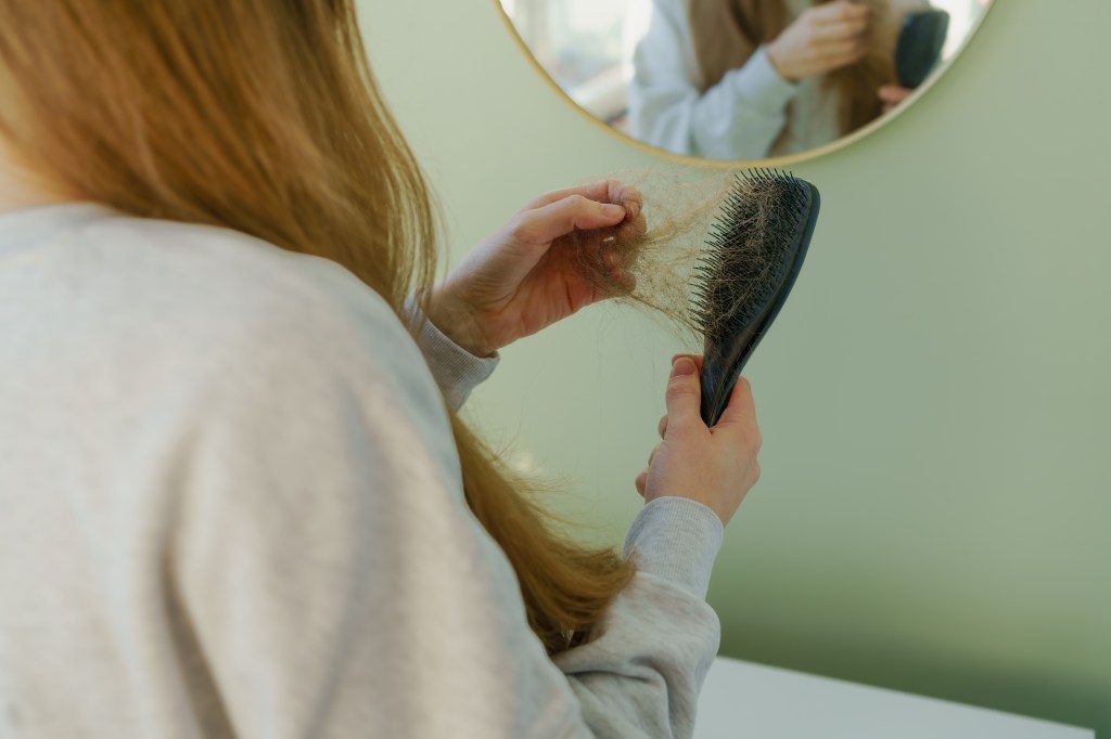 Does stress cause hair loss? How to know if it’s telogen effluvium or something else